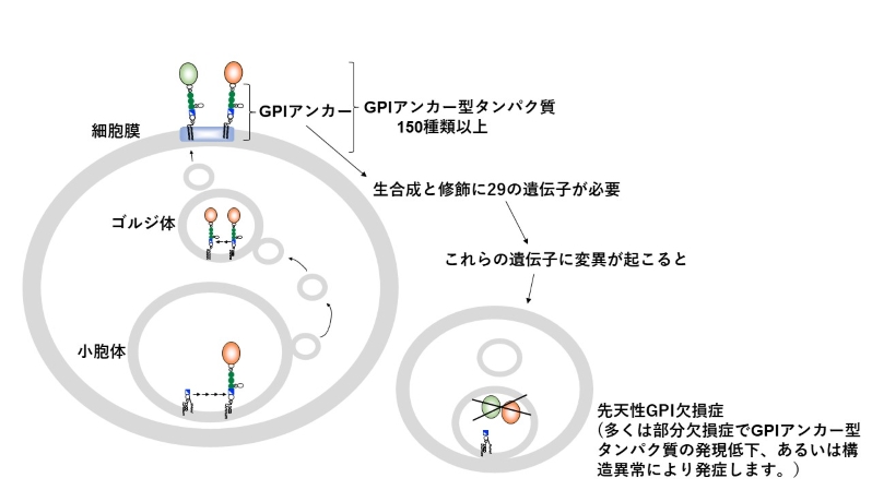 図は蛋白質の細胞膜への結合に関与しているGPIアンカーの合成と修飾に必要な遺伝子に変異が生じることで発症する先天性GPI欠損症の由来を示している